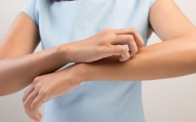 Alergias de verão: Saiba como prevenir